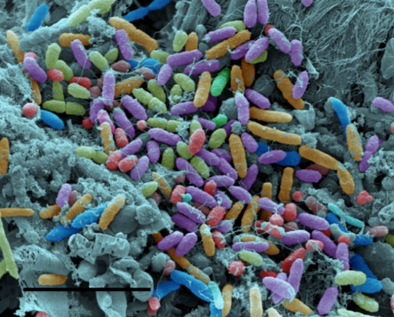 Microbiomics | Leeds Omics